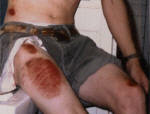 Yikes!  Now thats pain!